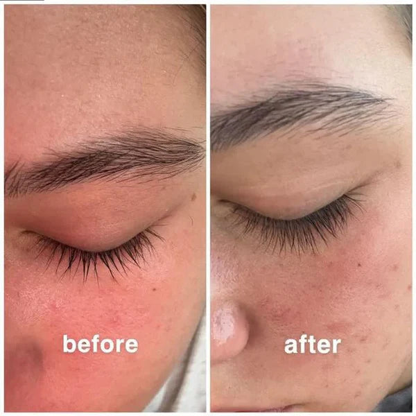 Eyelash Growth Serum™