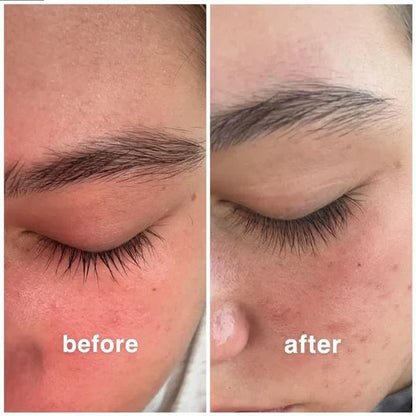Eyelash Growth Serum™