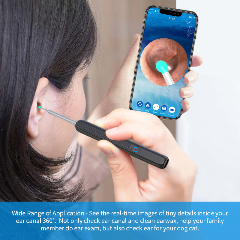 NE3 Ear Cleaner Otoscope™