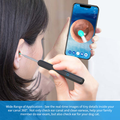 NE3 Ear Cleaner Otoscope™