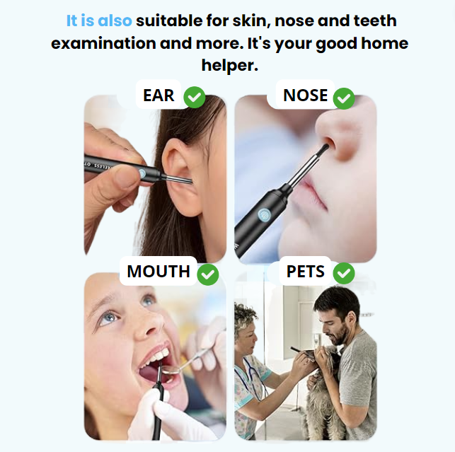 NE3 Ear Cleaner Otoscope™