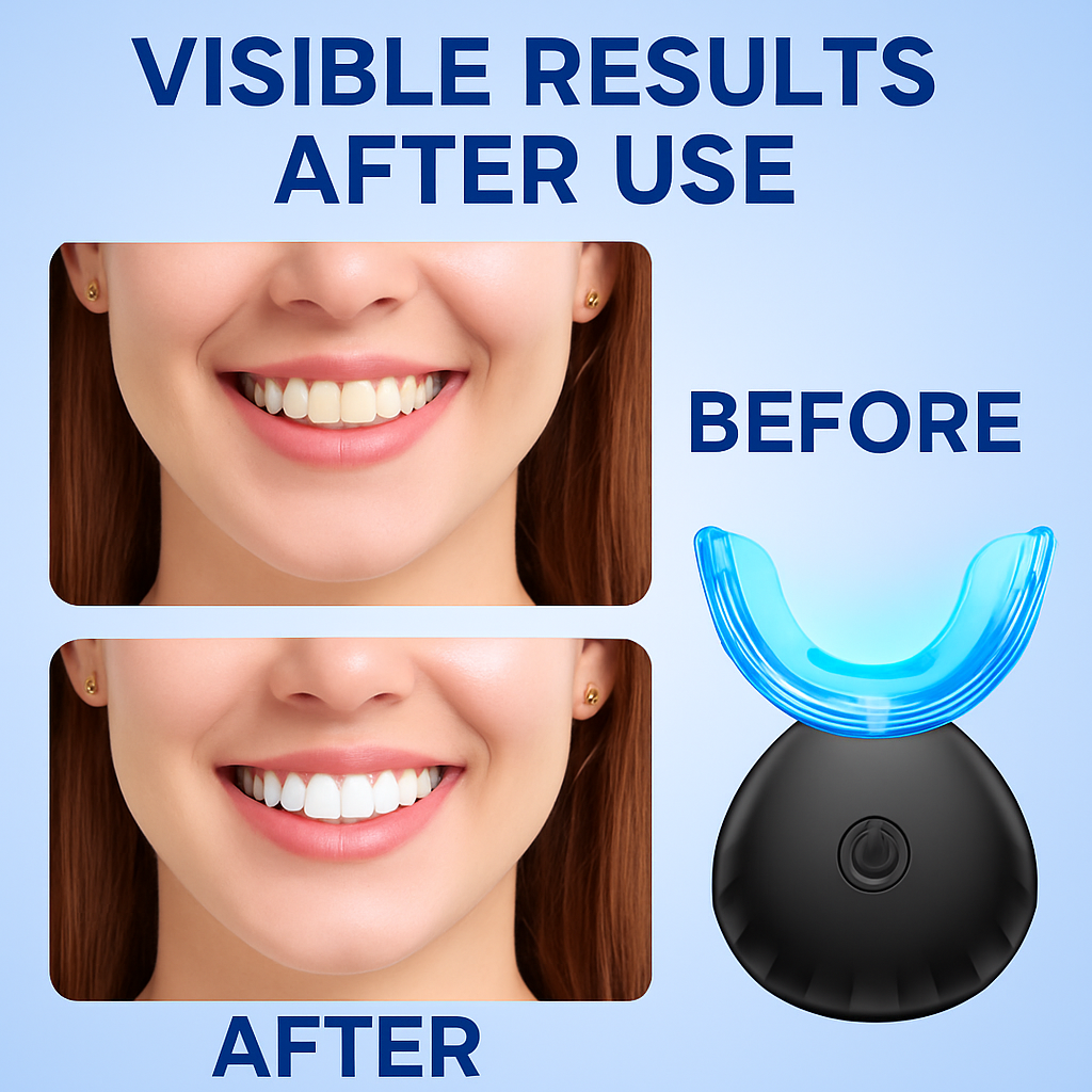 Teeth Whitening Kit™