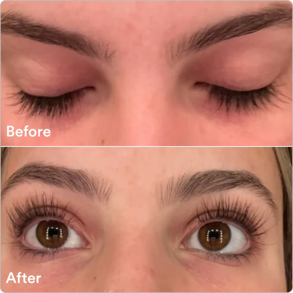 Eyelash Growth Serum™