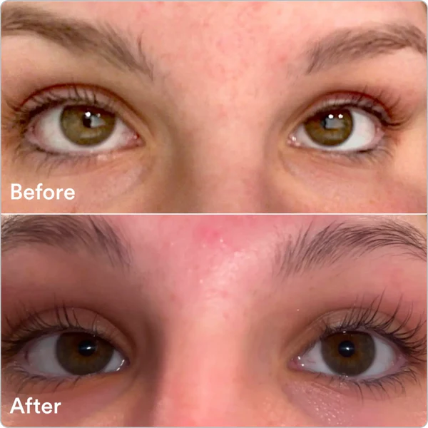 Eyelash Growth Serum™