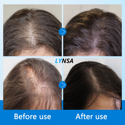 Root Revive Hair Growth Oil