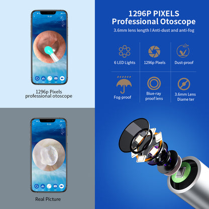 NE3 Ear Cleaner Otoscope™